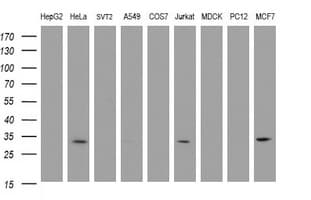 Monoclonal Mouse anti-Human SRPRB Antibody (clone OTI2B9, IHC, WB)