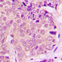 Polyclonal Rabbit anti-Human PEA15 / PEA-15 Antibody (C-Terminus, IHC, IF, WB)
