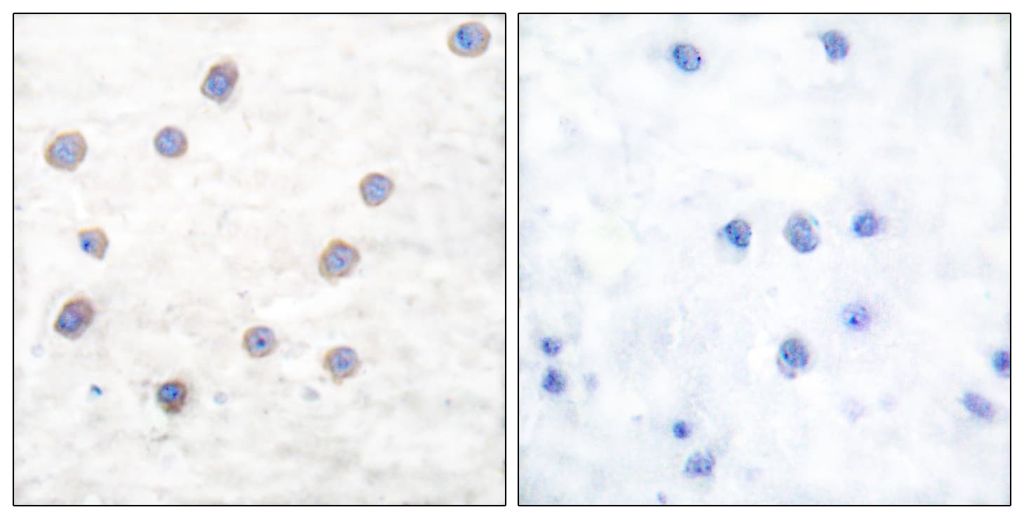 Polyclonal Rabbit anti-Human TH / Tyrosine Hydroxylase Antibody (phospho-Ser40, IHC, WB)