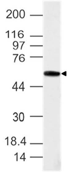 Polyclonal Rabbit anti-Human TBXT / T / Brachyury Antibody (aa200-410, WB)