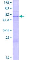Human SUN1 Protein (Recombinant GST)
