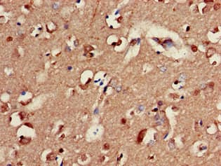 GABRA2 Antibody