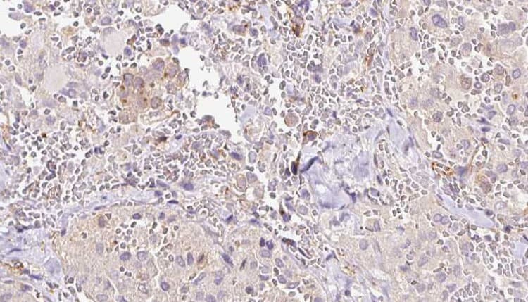 RLBP1 / CRALBP Antibody