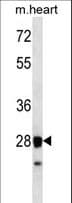 Polyclonal Rabbit anti-Human STX8 / Syntaxin 8 Antibody (aa8-36, WB)