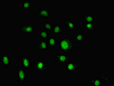 Polyclonal Rabbit anti-Human GTF2H5 Antibody (WB)