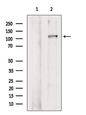 Polyclonal Rabbit anti-Human BRD8 Antibody (WB)