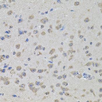 Polyclonal Rabbit anti-Human MAPK1 / ERK2 Antibody (IHC, WB)