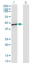 CPB / Carboxypeptidase B Antibody (clone 4D5)