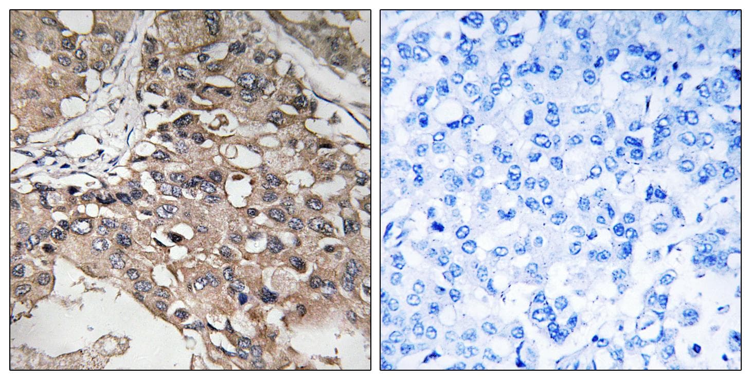 Polyclonal Rabbit anti-Human MAP3K7 / TAK1 Antibody (p187, IHC, WB)