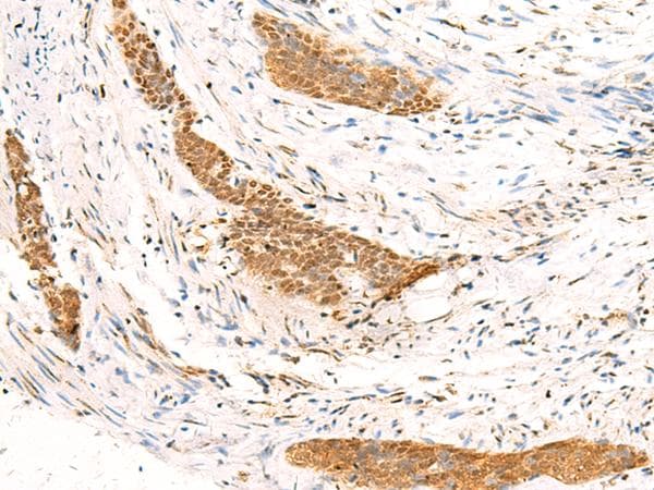 HTT / Huntingtin Antibody