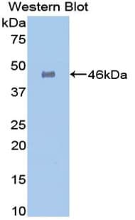 GLA / Alpha Galactosidase Antibody (aa81-429)