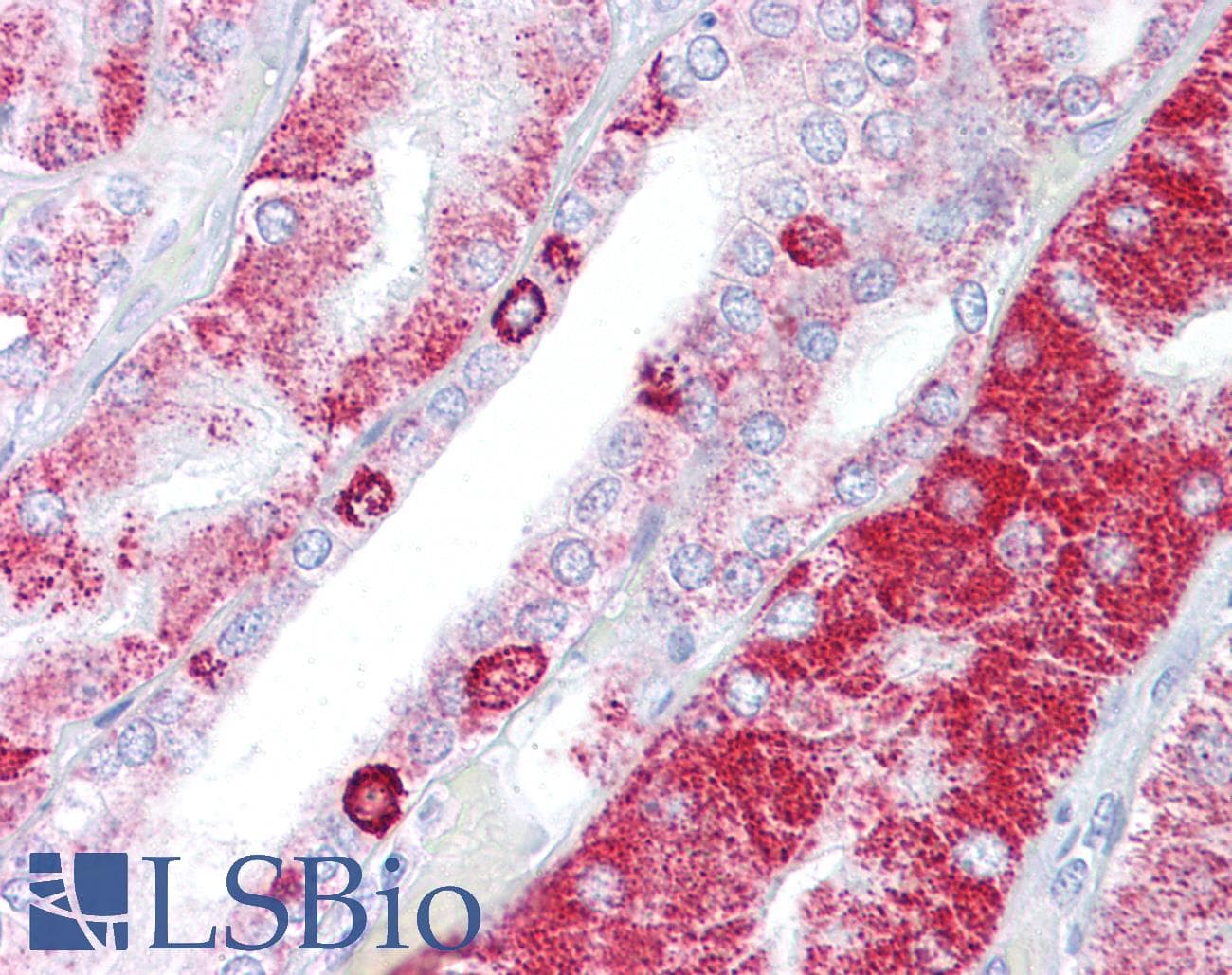 IHC-plus™ ACAT1 Antibody (aa296-329)
