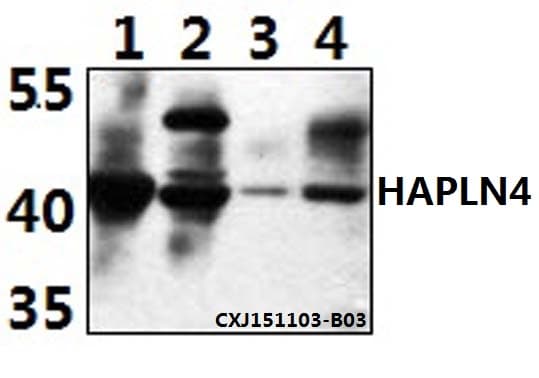 Polyclonal Rabbit anti-Human HAPLN4 Antibody (aa114-159, WB)