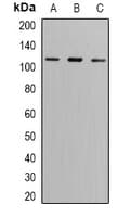 Polyclonal Rabbit anti-Human GRIK2 / GLUR6 Antibody (IF, WB)