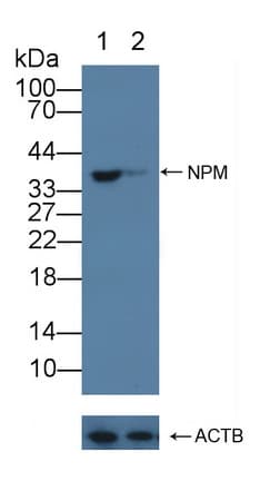 NPM1 / NPM / Nucleophosmin Antibody (aa212-292)