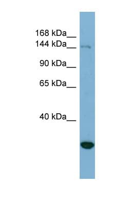 Polyclonal Rabbit anti-Human JARID2 / JMJ Antibody (aa215-264, WB)