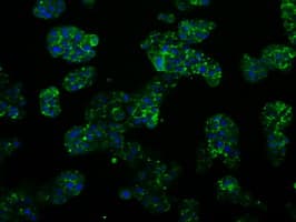 Monoclonal Mouse anti-Human PSMC3 Antibody (clone OTI1C10, IHC, IF, WB)