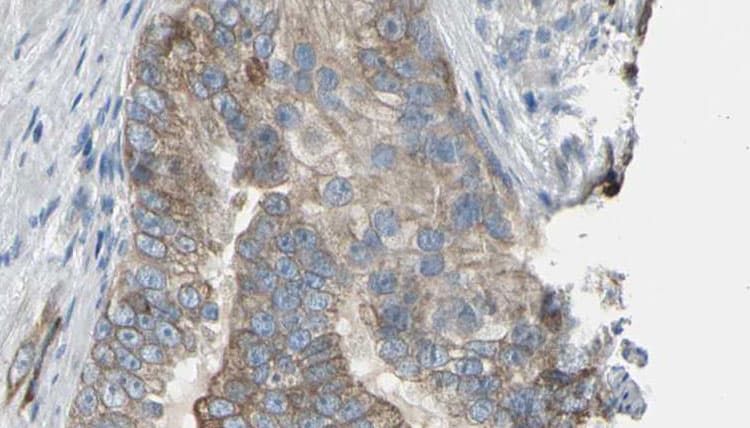 Polyclonal Rabbit anti-Human TPMT Antibody (IHC, WB)