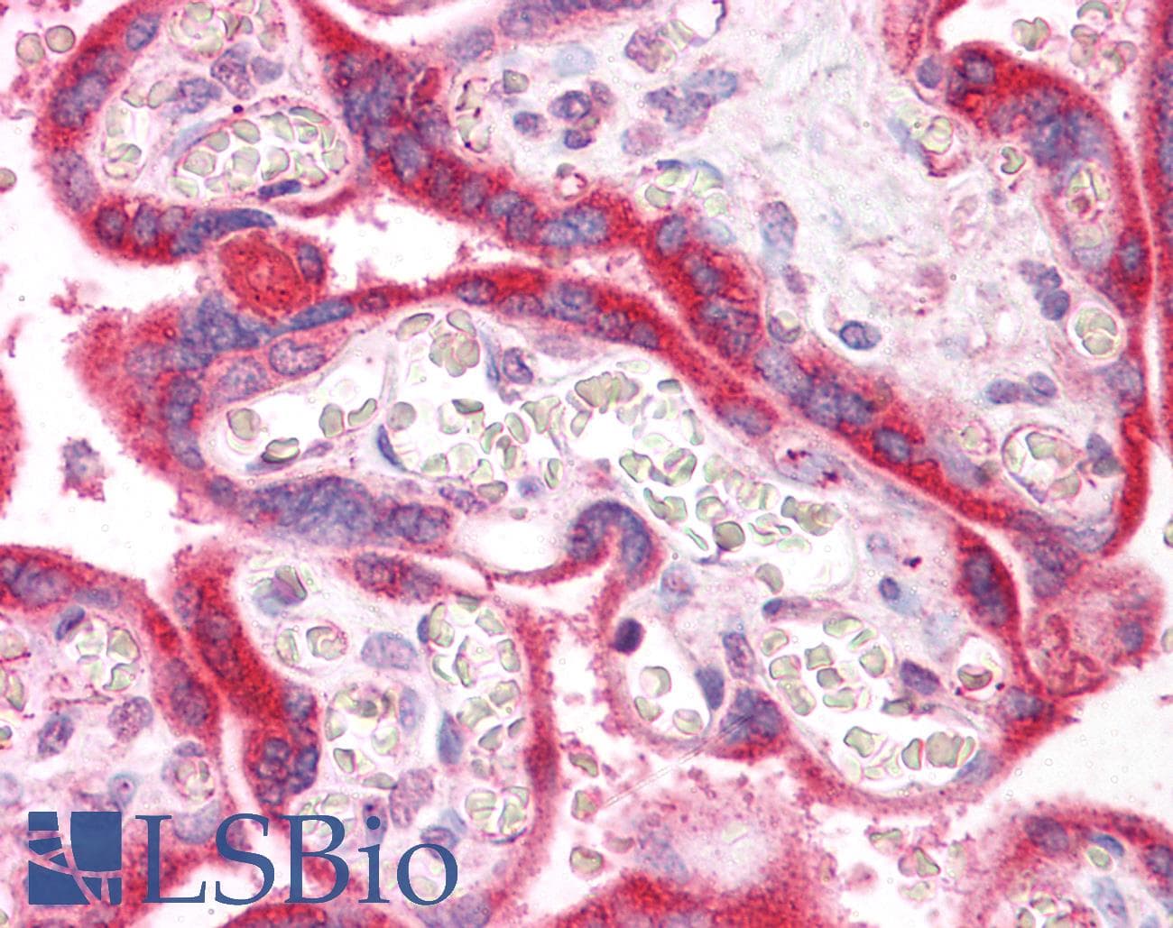 IHC-plus™ IRAK1 / IRAK Antibody (clone 3F7)