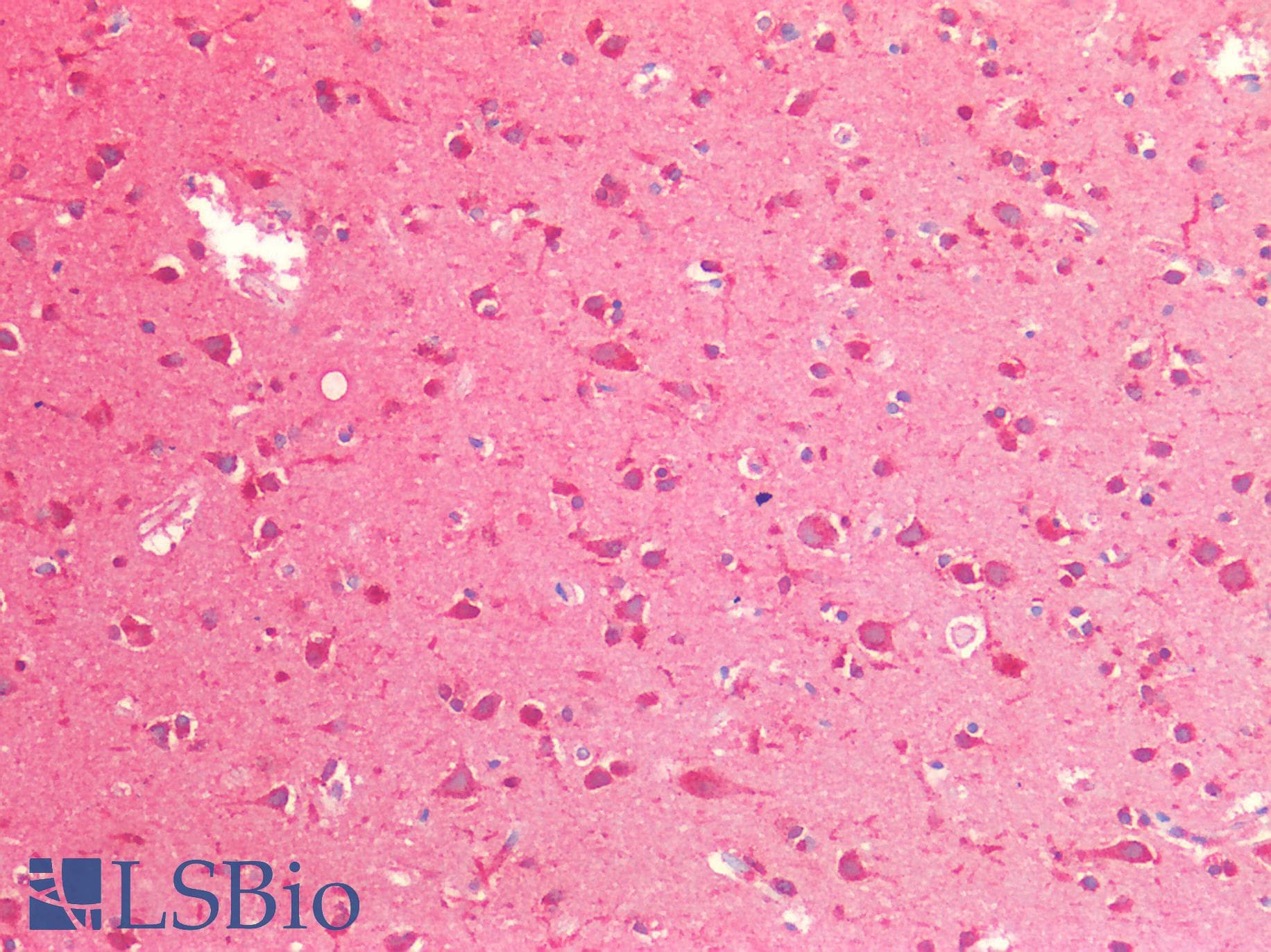 IHC-plus™ Polyclonal Rabbit anti-Human CTSB / Cathepsin B Antibody (IHC)