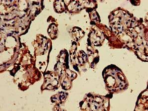 Polyclonal Rabbit anti-Human ALK-6 / BMPR1B Antibody (IHC, IF, WB)