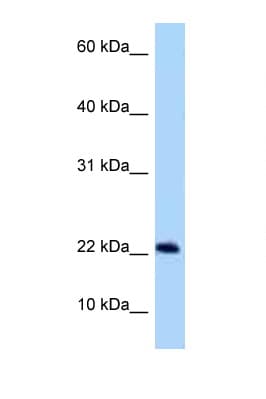 C9orf9 Antibody (aa30-79)