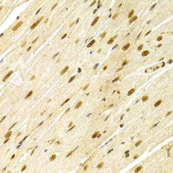 Polyclonal Rabbit anti-Human MAPK3 / ERK1 Antibody (IHC, IF, WB)