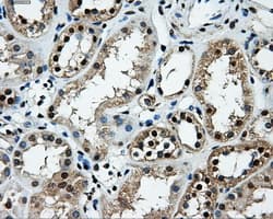 Monoclonal Mouse anti-Human LOX / Lysyl Oxidase Antibody (clone OTI6B11, IHC, IF, WB)