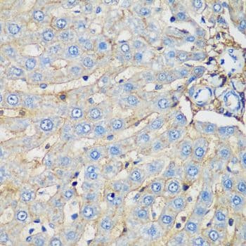 Polyclonal Rabbit anti-Human PROCR / EPCR Antibody (IHC, WB)