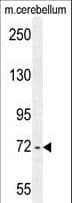 ZBTB24 / BIF1 Antibody (aa137-166)
