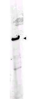 IHC-plus™ ROBO1 Antibody (aa1625-1650)