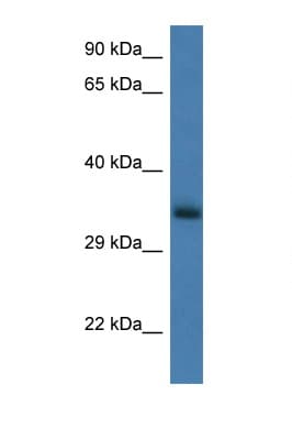 GNPDA1 Antibody (aa50-99)