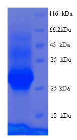 Human CEMP1 Protein (Recombinant His)