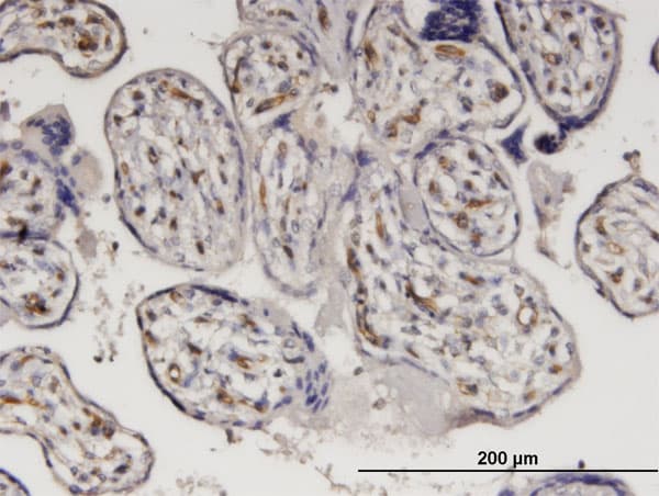 BABP / AKR1C2 Antibody (clone 1G1)