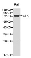 Polyclonal Rabbit anti-Human SYK Antibody (IHC, WB)