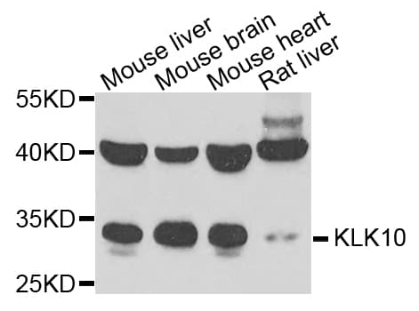 IHC-plus™ KLK10 / Kallikrein 10 Antibody