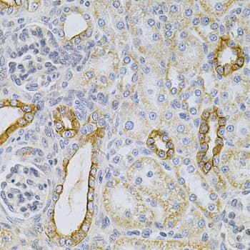 KRT20 / CK20 / Cytokeratin 20 Antibody