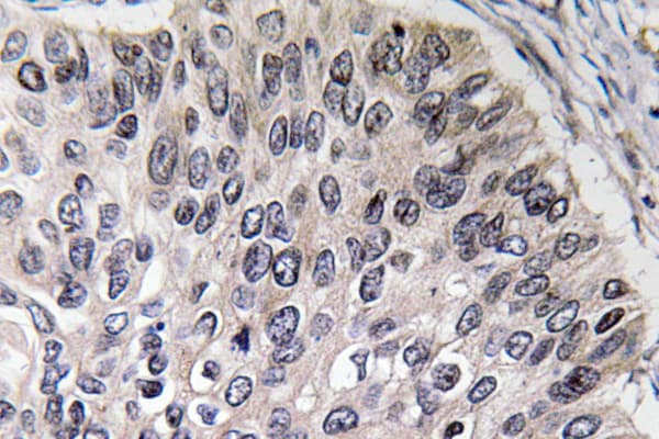 CA2 / Carbonic Anhydrase II Antibody (aa180-229)