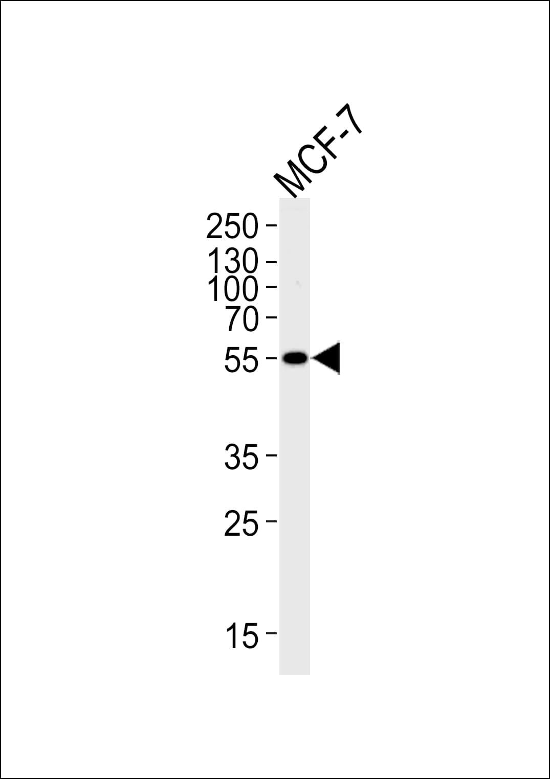 ALDH6A1 Antibody