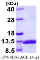 Human GCG / Glucagon Protein (Recombinant His)