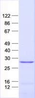 Human TMED3 Protein (Recombinant His, N-Terminal)