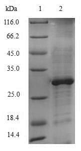 Saccharomyces cerevisiae CYP51A1 / CYP51 Protein (Recombinant GST, N-terminus)