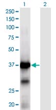 Monoclonal Mouse anti-Human XPA Antibody (clone 2E4, IF, WB)