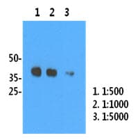 Influenza A Virus H1 Antibody (clone AT1G7)