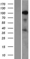SRRM1 Protein (Over-Expression Lysate Myc-DDK (Flag))