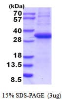 Human CD207 / Langerin Protein (Recombinant His)