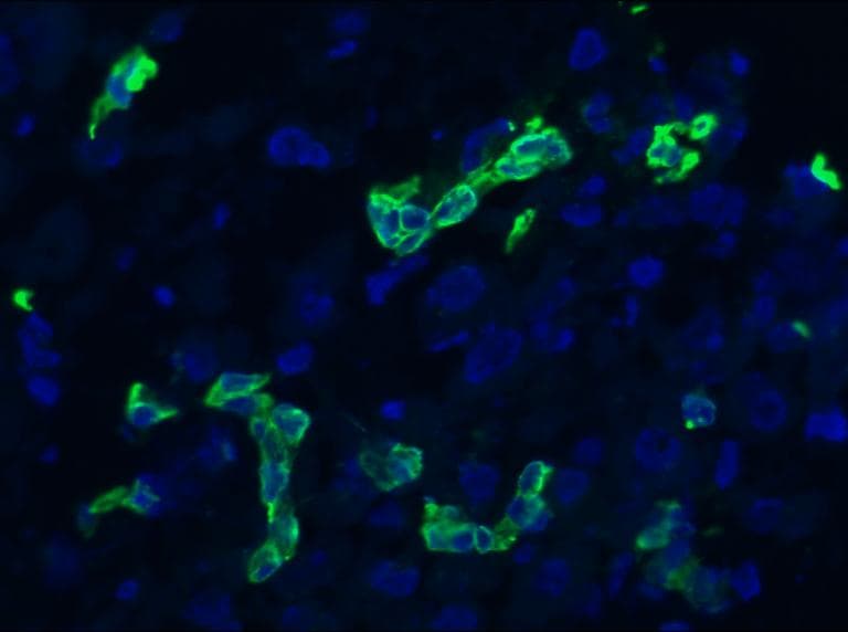 IHC-plus™ KRT19 / CK19 / Cytokeratin 19 Antibody (clone RCK108)