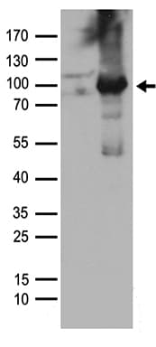 PRKCD / PKC-Delta Antibody