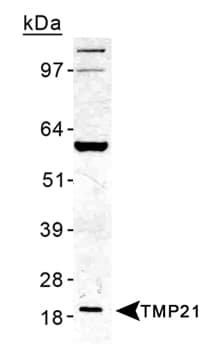 TMED10 / TMP21 Antibody (Internal, DY650)
