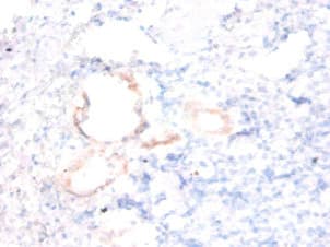 ENSA Antibody